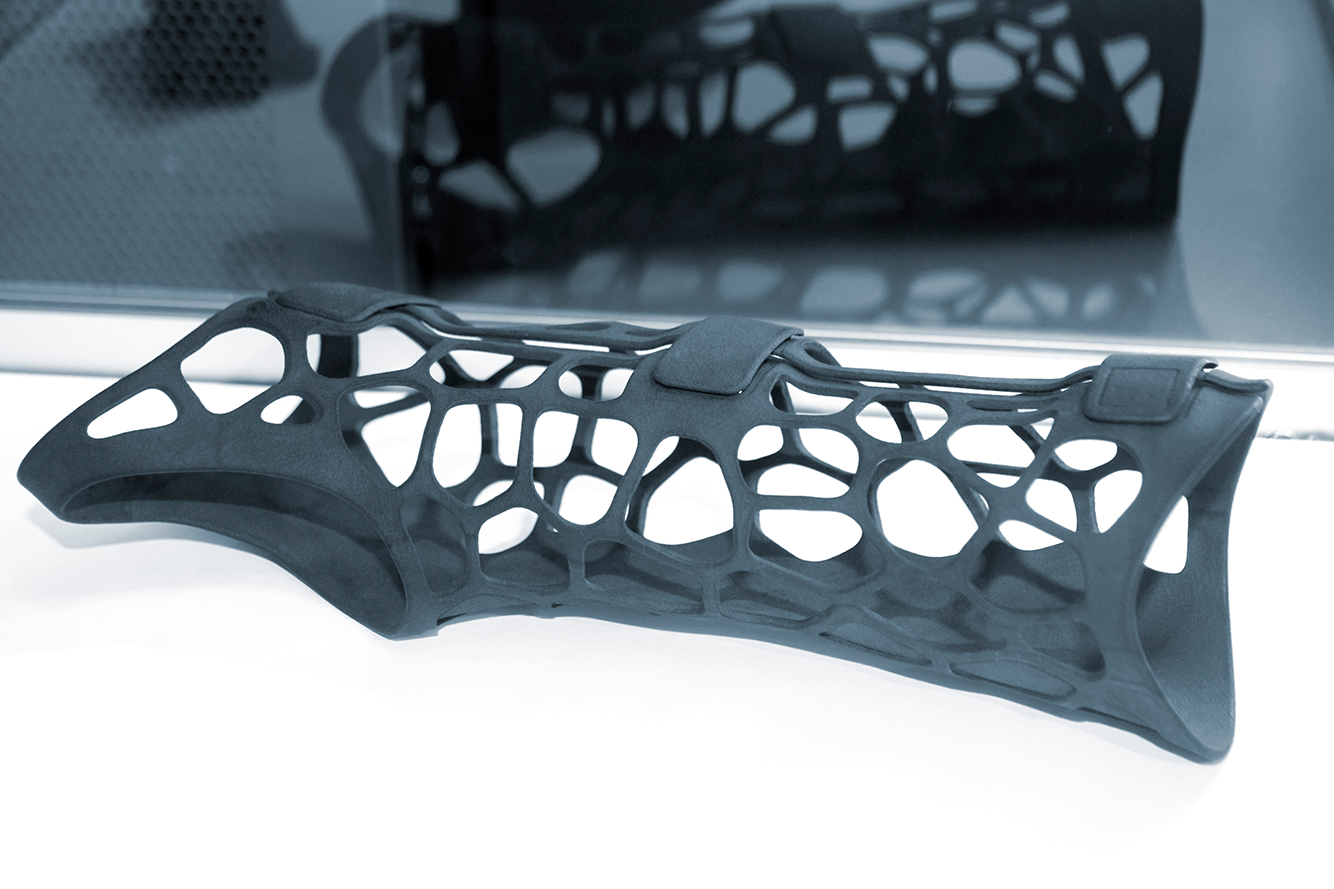 3D gedruckte orthopädische Kunststoffprothese fürs Handgelenk