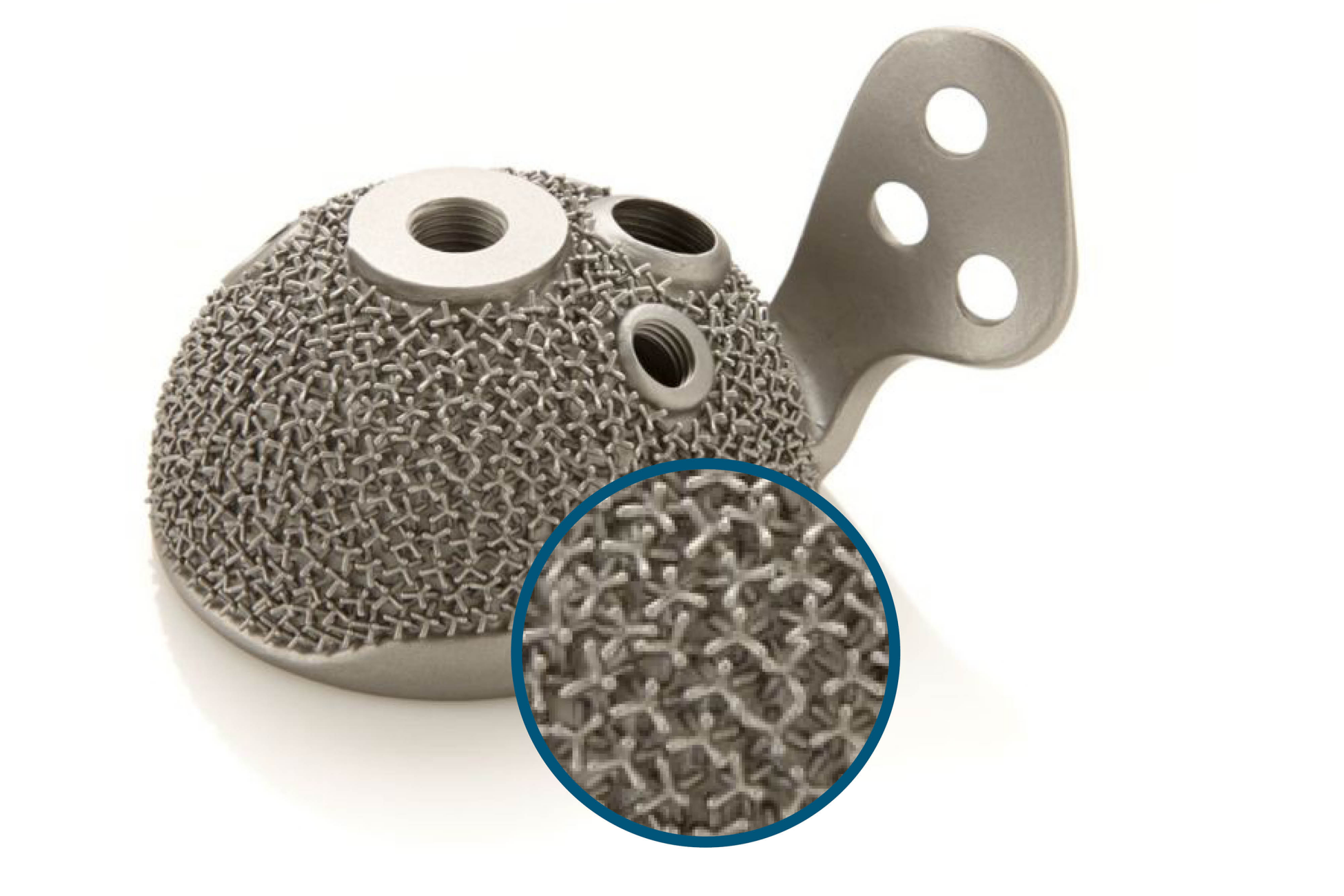 Hüftpfanne mit Feinguss hergestellt